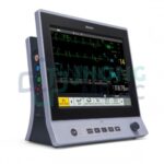 MONITOR DE 5 PARAMETROS EDAN X12